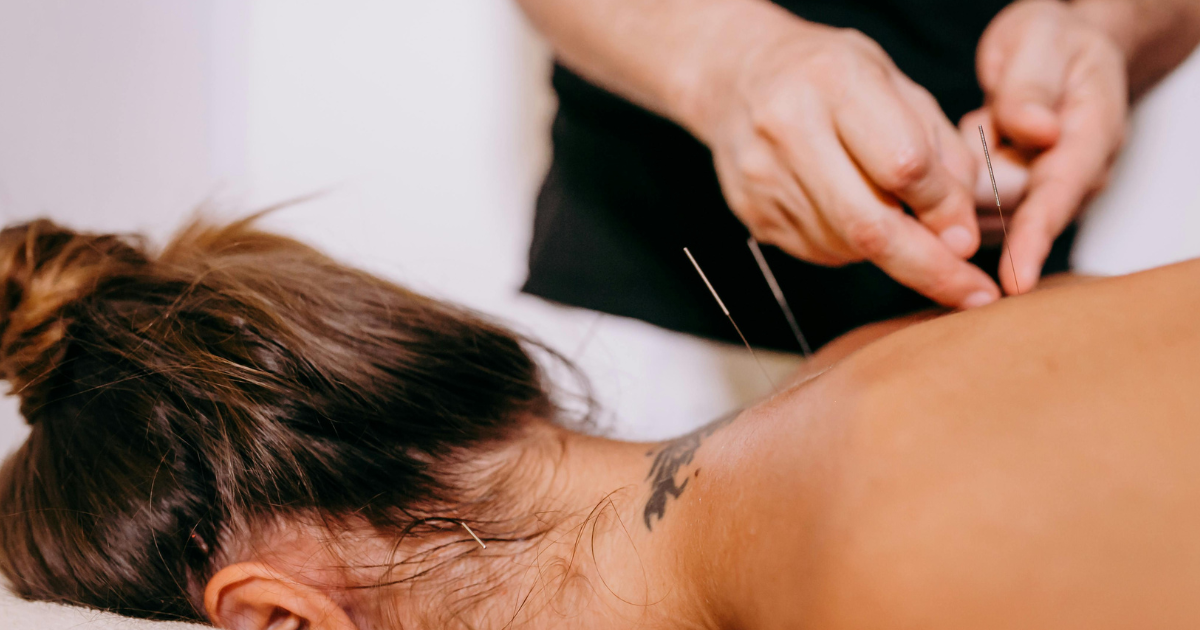 Austin Texas Acupuncture: A Holistic Path to Health and Well-Being